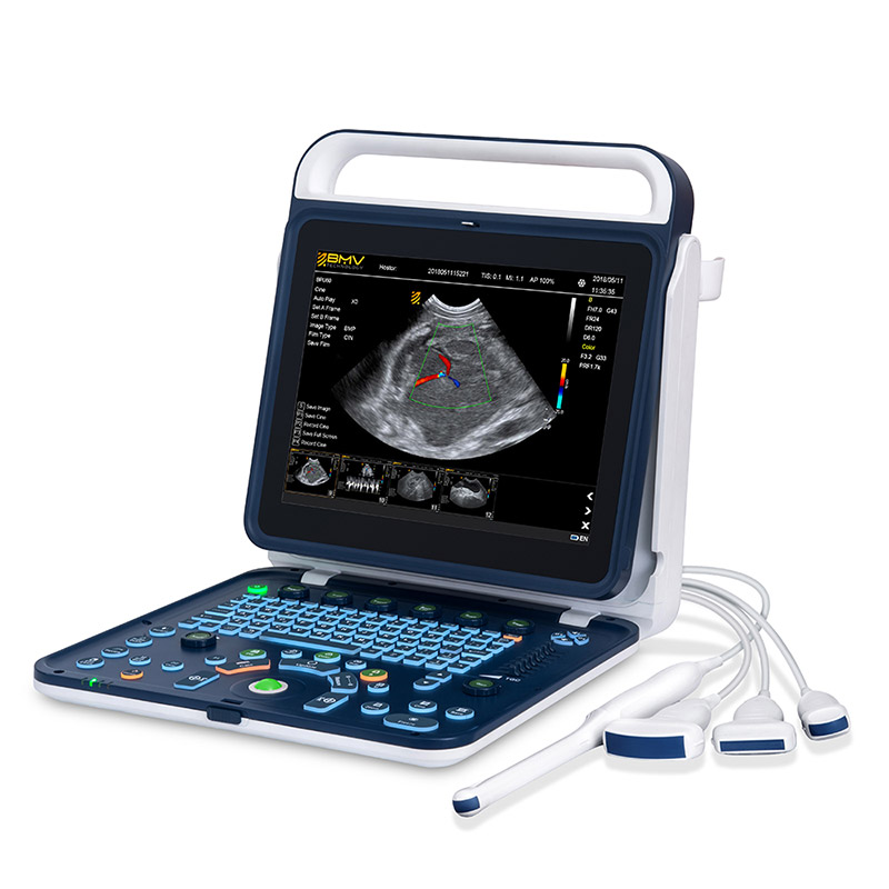 bpu60 ultrasound scanner