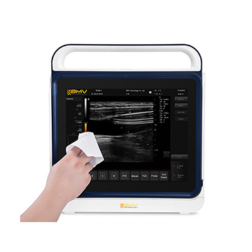 pt60 color Doppler ultrasound