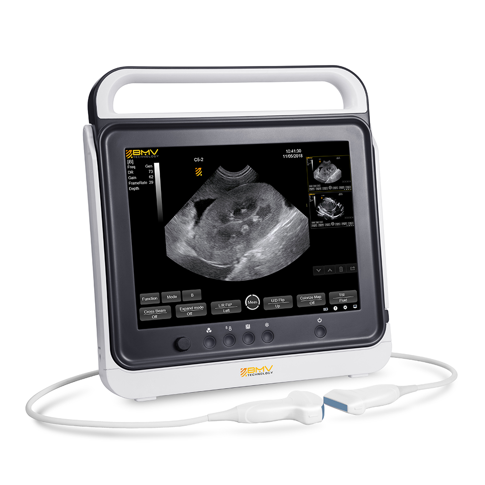 PT50A ultrasound system